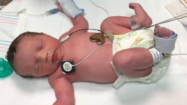 Lynlee la bimba nata due volte - ilponente.com