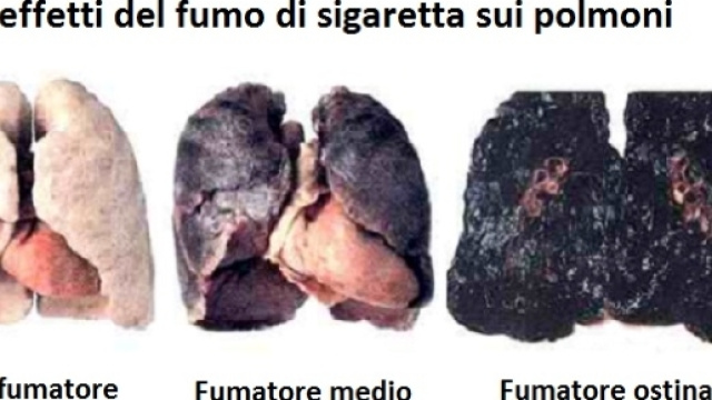 Lo scetticismo pu&ograve; essere pericoloso ma, nel rapporto fumo-cancro, pu&ograve; diventare mortale.
