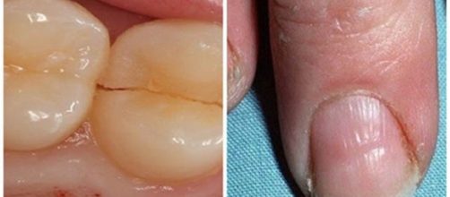 Sinais de que pode estar muito doente