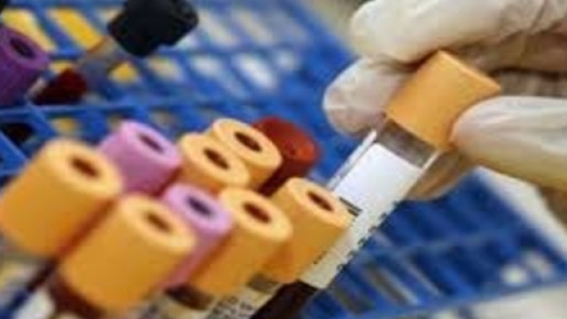La proteina in questione appartiene alla famiglia delle anidrasi