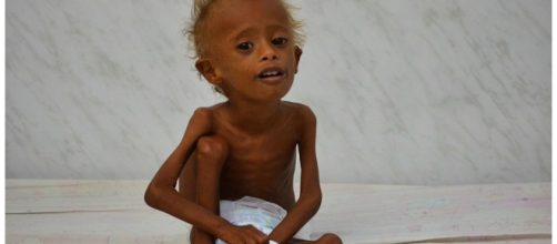 Salem Issa est&aacute; t&atilde;o magro que nem consegue comer