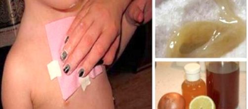 Receita promete eliminar a tosse e o catarro