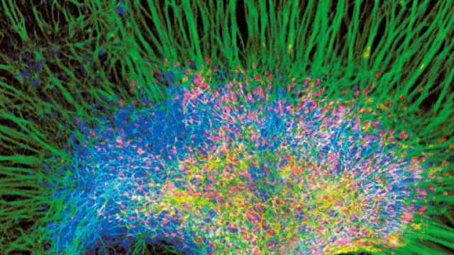 Cellule nervose durante lo sviluppo (http://www.treccani.it/enciclopedia/cellule-staminali-neurali_(Dizionario-di-Medicina)/)