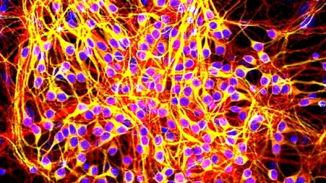 La proteina Tau, in rosso, si accumula sopratutto a livello dei dendriti e degli assoni (https://en.wikipedia.org/wiki/Tau_protein)