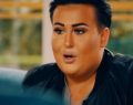 Body Fixers star Henry Banham talks horrifying lip filler experience