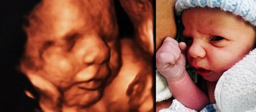 Bebe escondido foi descoberto nos &uacute;ltimos meses da gesta&ccedil;&atilde;o