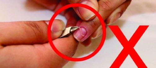 Dermatologista e especialista em unhas aconselha que voc&ecirc; n&atilde;o deve cortar sua cut&iacute;cula