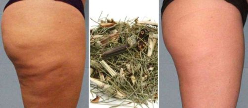 Veja dicas para acabar com a celulite