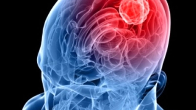 Meningite &egrave; allarme in Toscana