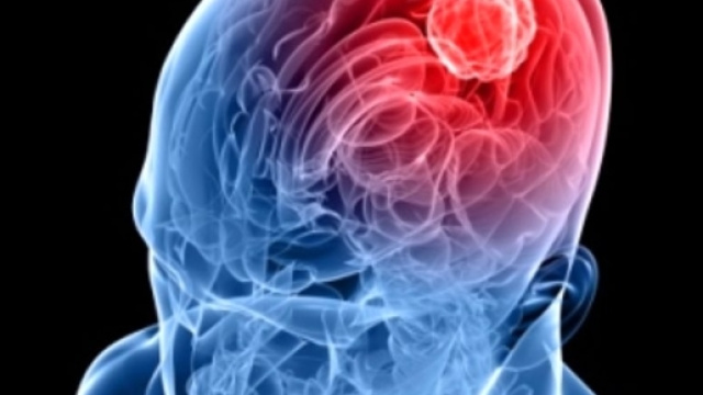 Meningite in Toscana ceppo di tipo C