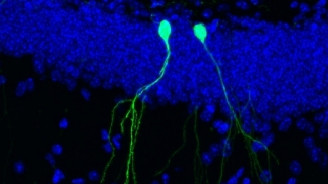Neuroni neonati proiettano le loro ramificazioni verso i neuroni circostanti (Image credit: Salk Institute)