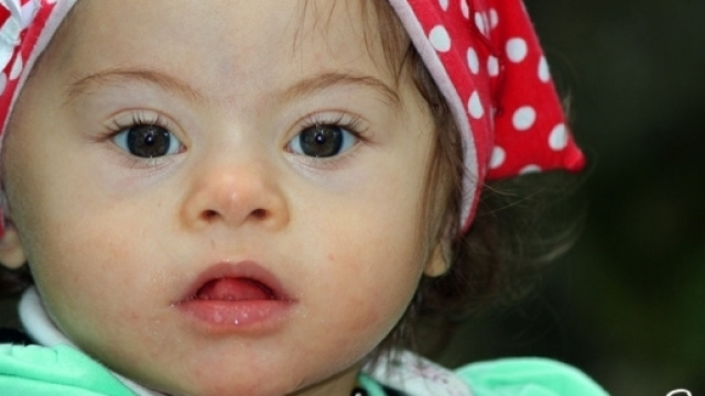 Gli occhi dei bimbi con sindrome di Down - Sindrome di Down ... - guardaconilcuore.org
