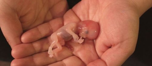 3 meses: ainda n&atilde;o &eacute; uma vida?