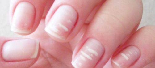 Voc&ecirc; possui essas manchas? Elas podem ser sinal de doen&ccedil;a