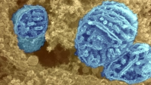 Mitocondri fotografati al microscopio elettronico (Wellcome Trust)