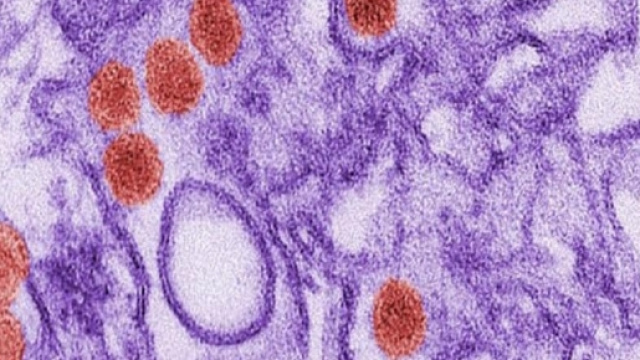 Contro l'Alzheimer si sta provando una nuova terapia