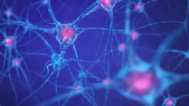 IL TEMPO &Egrave; CERVELLO: IMPORTANZA DI DIAGNOSI PRECOCE ED INTERVENTO ... - radiowellness.it