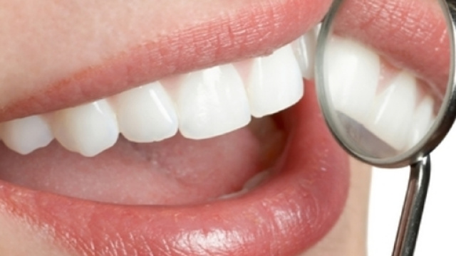 Dentisti low cost: fate attenzione alle truffe