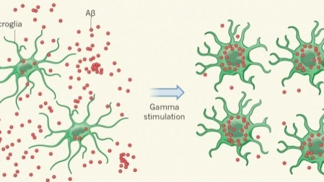 La stimolazione a 40 Hz provoca un riassorbimento delle placche amiloidi (dal commento di Aron e Yankner su Nature 2016)