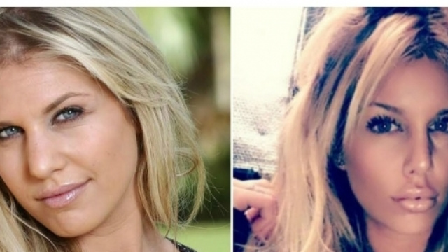 Les candidates de t&eacute;l&eacute;-r&eacute;alit&eacute; et la chirurgie esth&eacute;tique