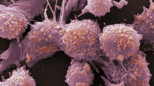 Combinando l&rsquo;azione di una sostanza fotosensibile con un raggio laser di luce rossa, si pu&ograve; distruggere, in sicurezza, il tumore alla prostata.