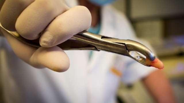 Il dentista esercitava la professione senza il certificato di laurea