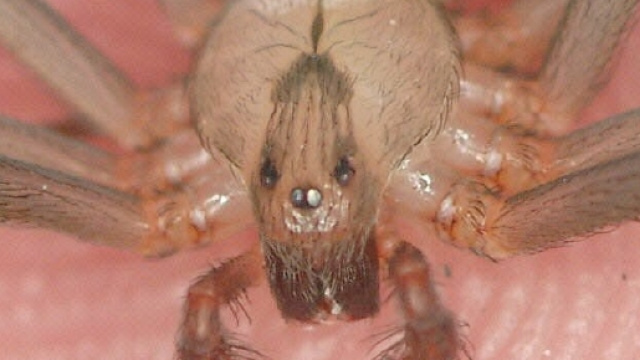 Pordenone, ragno violino morde 25enne a una caviglia