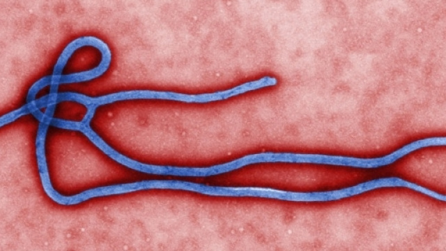 Immagine del virus ebola inattivo.