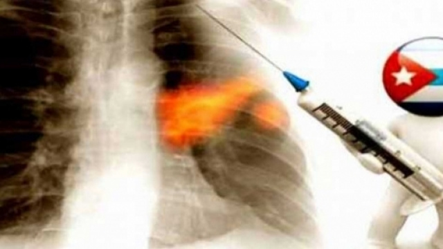 _omissis_ Cuba mostra i risultati del vaccino CimaVax-EGF contro ... - omissisnews.com