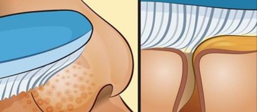 Limpeza surpreendente no nariz