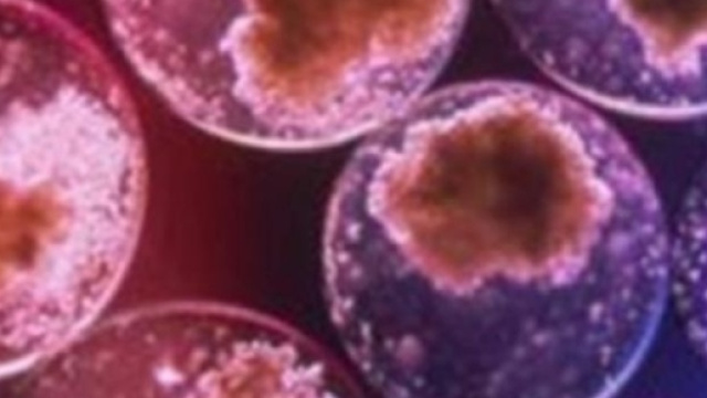 Esiste una relazione tra i grassi saturi e le metastasi