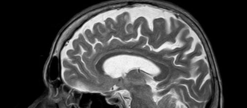 Image courtesy toubibe pixabay.com creative commons license