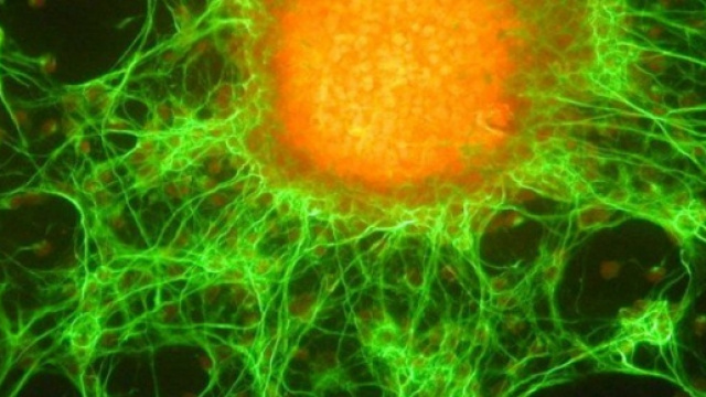 Nuova tecnica per la cura dei tumori