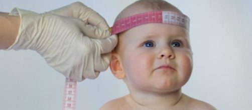 Aumento de casos de microcefalia reacende debates.