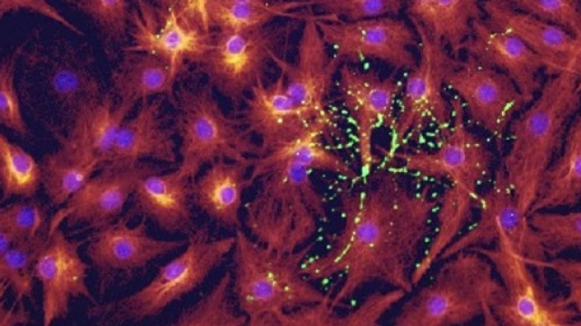 Cellule staminali della memoria immunologica.