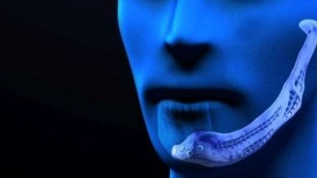 Primo trapianto di mandibola in Italia