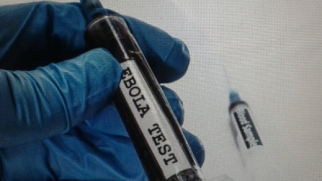 Nuove scoperte contro il virus Ebola