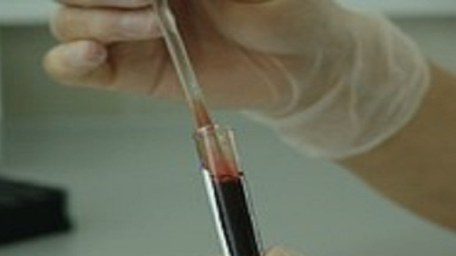 Il virus Zika e la microcefalia