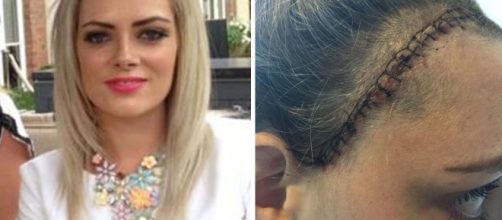 A craniotomia de Emily Corrigan