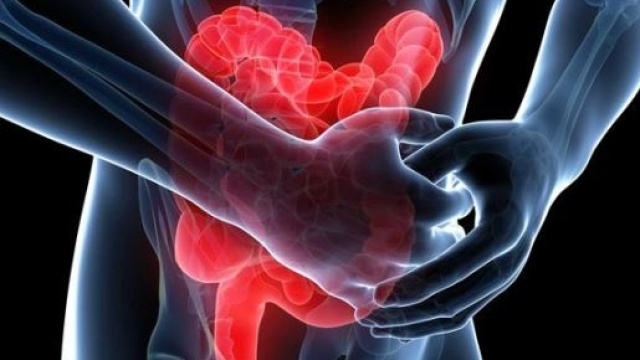 La dieta giusta per l'infiammazione intestinale