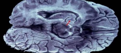 hallucinations show bad relationship in the brain