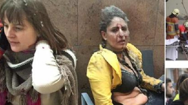 Alcuni feriti sopravvissuti agli attacchi.