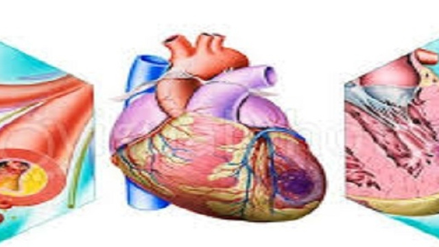 Abbassata l'et&agrave; media dell'infarto