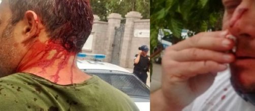 Roberto Macho, golpeado ferozmente hoy