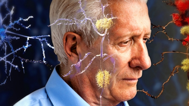 Speranze per la terapia dell'Alzheimer da una sostanza del sistema immunitario