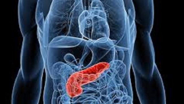 Due batteri del cavo orale associati all'insorgenza del cancro al pancreas.