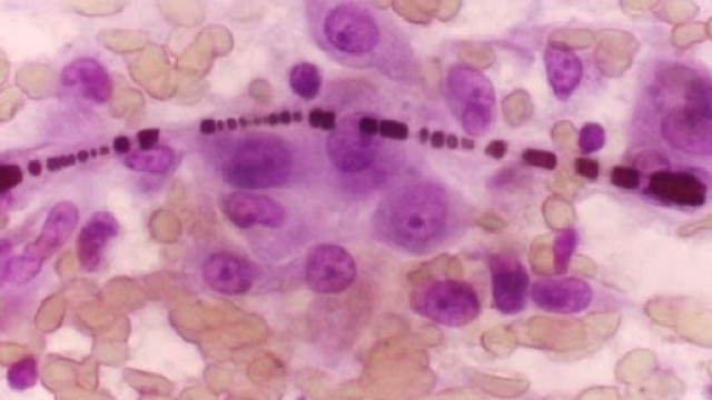 Cancro: forse sono in arrivo nuove cure