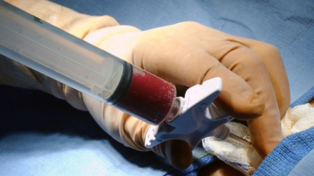 Legalizzare mercato degli organi per favorire i trapianti?