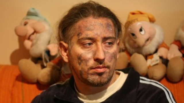 Antonio Boccuzzi sopravvissuto al rogo della Thyssen