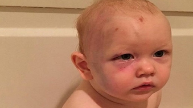 Il piccolo Jacob di Sherwood, Oregon.